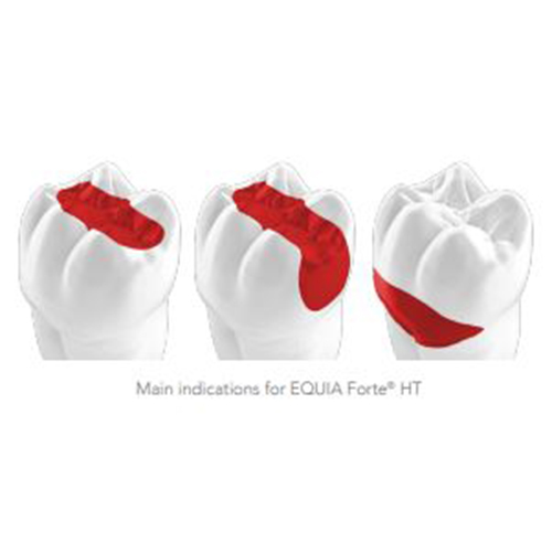 GC EQUIA Forte HT Fil - Image 3